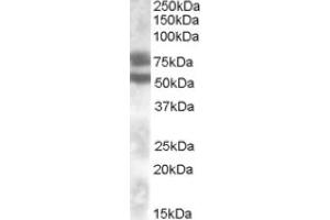 Image no. 1 for anti-Dachshund 1 (DACH1) (Internal Region) antibody (ABIN375187) (DACH1 anticorps  (Internal Region))