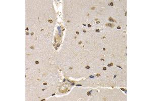 Immunohistochemistry of paraffin-embedded rat brain using HIST4H4 antibody at dilution of 1:200 (400x lens). (Histone H4 anticorps)