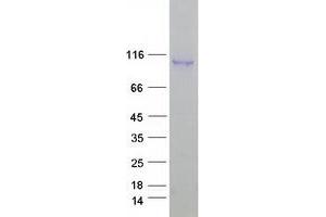 Validation with Western Blot