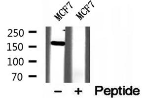 Western blot analysis of extracts of MCF7 cells, using ZCCHC11 antibody. (ZCCHC11 anticorps  (Internal Region))