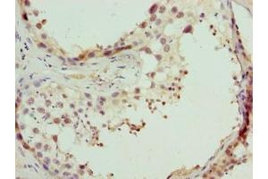 Immunohistochemistry of paraffin-embedded human testis tissue using ABIN7148653 at dilution of 1:100 (CPXCR1 anticorps  (AA 1-301))