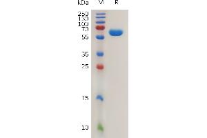 Human CA12 Protein, hFc Tag on SDS-PAGE under reducing condition.
