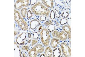 Immunohistochemistry of paraffin-embedded rat kidney using CC2D1A Rabbit pAb (ABIN1679010, ABIN3019218, ABIN3019219 and ABIN6220767) at dilution of 1:200 (40x lens). (CC2D1A anticorps  (AA 1-150))