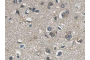 Detection of GAPDH in Human Cerebrum Tissue using Monoclonal Antibody to Glyceraldehyde-3-Phosphate Dehydrogenase (GAPDH)