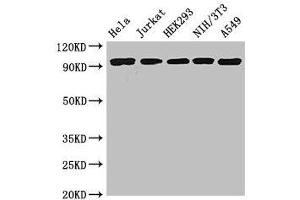 Western Blot Positive WB detected in: Hela whole cell lysate, Jurkat whole cell lysate, HEK293 whole cell lysate, NIH/3T3 whole cell lysate, A549 whole cell lysate All lanes: DDR2 antibody at 3. (DDR2 anticorps  (AA 447-540))