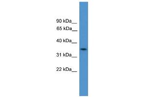 WB Suggested Anti-C4orf19 Antibody Titration:  0. (C4orf19 anticorps  (N-Term))