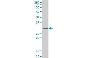 GSTZ1 monoclonal antibody (M01), clone 1G12 Western Blot analysis of GSTZ1 expression in HepG2 .