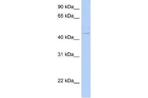 PSCD4 antibody used at 1 ug/ml to detect target protein. (Cytohesin 4 anticorps  (N-Term))