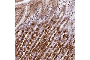 Immunohistochemical staining of human stomach with TMEM104 polyclonal antibody  shows strong cytoplasmic and nuclear positivity in glandular cells at 1:200-1:500 dilution. (TMEM104 anticorps)