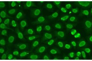 Immunofluorescence analysis of HeLa cells using FEN1 Polyclonal Antibody (FEN1 anticorps)
