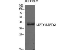 Western Blot (WB) analysis of HepG2-UV cells using Lefty Polyclonal Antibody. (LEFTY1 anticorps  (Internal Region))