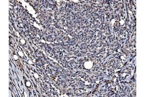 IHC analysis of DYNLL1/PIN using anti-DYNLL1/PIN antibody (ABIN7599571).