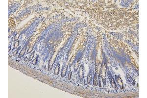 IHC analysis of RNF123 using anti-RNF123 antibody (ABIN6719387).