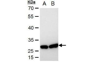 WB Image HSP27 antibody detects HSP27 protein by western blot analysis.