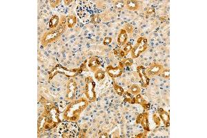 Immunohistochemistry of paraffin embedded mouse kidney using ARSK (ABIN7073123) at dilution of 1:2000 (300x lens) (Arylsulfatase K anticorps)