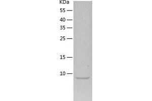 Western Blotting (WB) image for Pro-Brain Natriuretic Peptide (NT-ProBNP) (NT-ProBNP) (AA 27-76) protein (His tag) (ABIN7124559) (NT-ProBNP Protein (AA 27-76) (His tag))