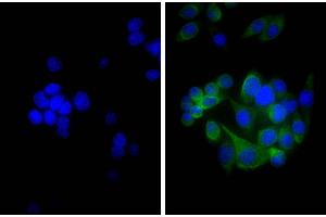 Human pancreatic carcinoma cell line MIA PaCa-2 was stained with Mouse Anti-Cytokeratin 18-UNLB, and DAPI. (Chèvre anti-Souris Ig (Chain kappa) Anticorps (Biotin))