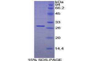 SDS-PAGE analysis of Mouse LILRB3 Protein. (LILRB3 Protéine)