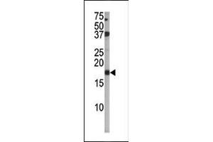 The anti-Phospho-p16-INK4A- Pab (ABIN6241061 and ABIN6578926) is used in Western blot to detect Phospho-p16-INK4A- in  tissue lysate