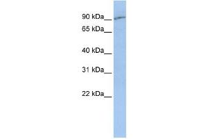 WB Suggested Anti-SLC15A2  Antibody Titration: 0. (SLC15A2 anticorps  (Middle Region))