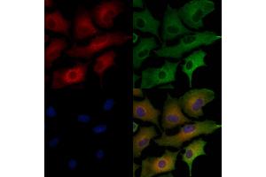 ABIN6259429 and ABIN6276255 staining  cells by IF/ICC.