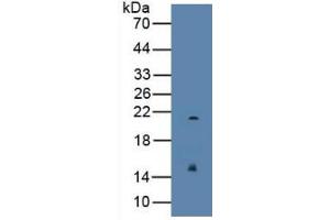 Mouse Capture antibody from the kit in WB with Positive Control: Human serum. (REG3g Kit ELISA)
