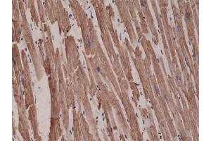 Immunohistochemical staining (Formalin-fixed paraffin-embedded sections) of human heart with ACTC1 monoclonal antibody, clone RM257  at a 1:1000 dilution. (ACTC1 anticorps  (N-Term))