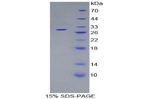 SDS-PAGE (SDS) image for Coagulation Factor XI (F11) (AA 170-398) protein (His tag) (ABIN2124411) (Factor XI Protein (AA 170-398) (His tag))