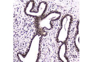 anti-Poly A Specific Ribonuclease (PARN) (AA 1-301) antibody