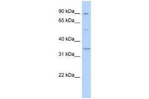 WNT9B antibody used at 1 ug/ml to detect target protein.