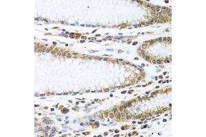 Immunohistochemistry of paraffin-embedded human stomach using IFI44 antibody (ABIN6135120, ABIN6142168, ABIN6142169 and ABIN6224213) at dilution of 1:100 (40x lens). (IFI44 anticorps)