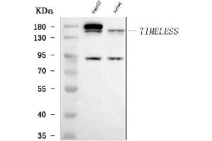 Western blot analysis of TIMELESS using anti-TIMELESS antibody (ABIN7602369).