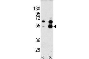 Western blot analysis of VEGFA antibody and 293 cell lysate either nontransfected (Lane 1) or transiently transfected with the VEGFA gene (2).