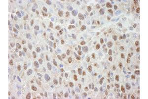 Immunohistochemistry (IHC) image for anti-Cullin 4A (CUL4A) (C-Term) antibody (ABIN7448505) (Cullin 4A anticorps  (C-Term))