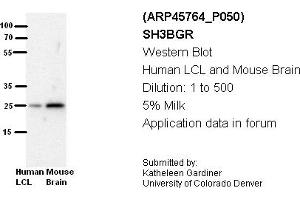 Image no. 2 for anti-SH3 Domain Binding Glutamic Acid-Rich Protein (SH3BGR) (N-Term) antibody (ABIN2782355) (SH3BGR anticorps  (N-Term))