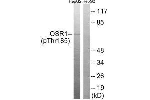 Western Blotting (WB) image for anti-Odd-Skipped Related 1 (OSR1) (pThr185) antibody (ABIN1847632) (OSR1 anticorps  (pThr185))