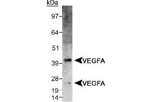 Image no. 2 for anti-Vascular Endothelial Growth Factor A (VEGFA) (AA 150-250), (Internal Region) antibody (ABIN363519) (VEGFA anticorps  (Internal Region))