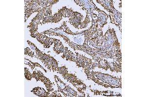 IHC analysis of Annexin A10/ANXA10 using anti-Annexin A10/ANXA10 antibody (ABIN7601853). (Annexin a10 anticorps  (AA 49-324))