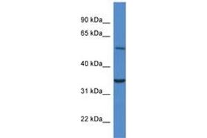 Image no. 1 for anti-Cytochrome B5 Reductase 4 (CYB5R4) (N-Term) antibody (ABIN6746476) (CYB5R4 anticorps  (N-Term))