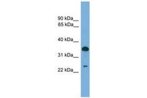 Image no. 1 for anti-Tumor Protein D52 (TPD52) (AA 81-130) antibody (ABIN6745546) (TPD52 anticorps  (AA 81-130))