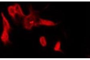 ABIN6278647 staining COLO205 by IF/ICC. (UBTD2 anticorps  (C-Term))