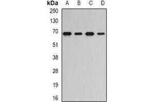 Western blot analysis of RNGTT expression in Jurkat (A), Hela (B), mouse spleen (C), rat kidney (D) whole cell lysates. (RNGTT anticorps)