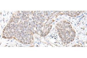 anti-Transcription Factor 25 (Basic Helix-Loop-Helix) (TCF25) antibody