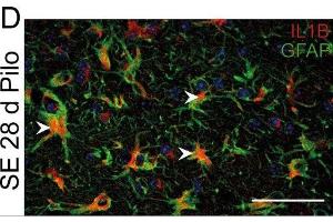 Immunostaining of mouse hippocampal CA1 region showing GFAP and IL1B labeling of astrocytes 28 days after pilocarpine induced status epilepticus (SE). (GFAP anticorps  (AA 411-422))