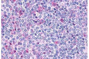 Anti-P2RY10 / P2Y10 antibody  ABIN1049202 IHC staining of human spleen, lymphocytes. (P2RY10 anticorps  (Extracellular Domain))