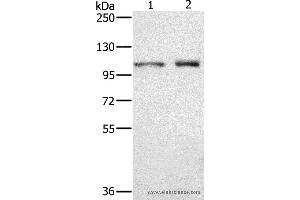 Western blot analysis of  Human testis tissue and K562 cell, using ODF2 Polyclonal Antibody at dilution of 1:650