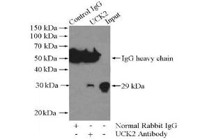 Immunoprecipitation analysis of Jurkat cells lysate 400 μg using UCK2 Antibody at a dilution of 1/1000. (UCK2 anticorps)