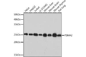 Western blot analysis of extracts of various cell lines, using PSM Rabbit mAb (ABIN7269597) at 1:1000 dilution. (PSMA2 anticorps)