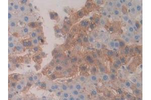 Detection of CBG in Rat Liver Tissue using Polyclonal Antibody to Corticosteroid Binding Globulin (CBG) (SERPINA6 anticorps  (AA 267-390))