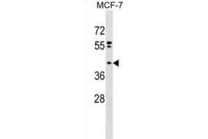 Western Blotting (WB) image for anti-Phosphatidic Acid Phosphatase Type 2 Domain Containing 2 (PPAPDC2) antibody (ABIN2999607) (PPAPDC2 anticorps)